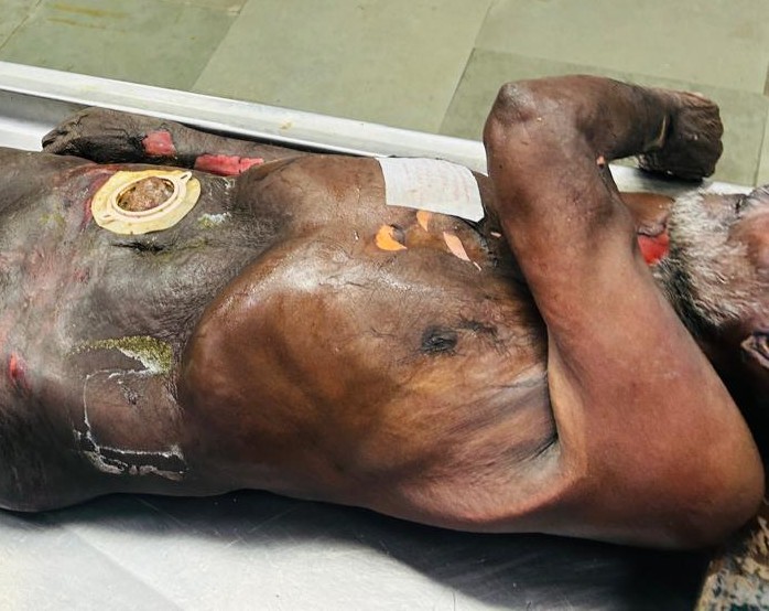 Scar Image